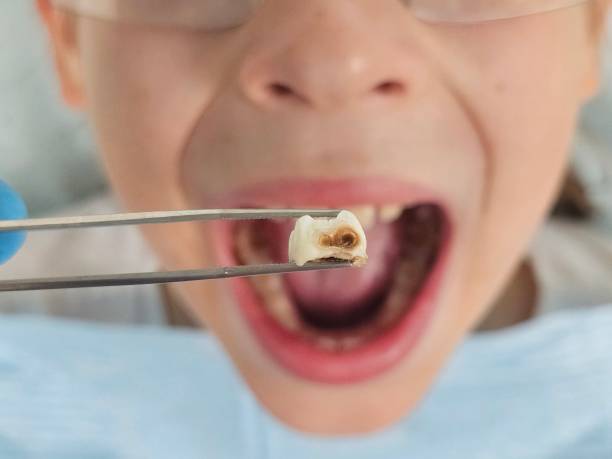 Best Orthodontic Emergency Dentist in Aetna Estates, CO