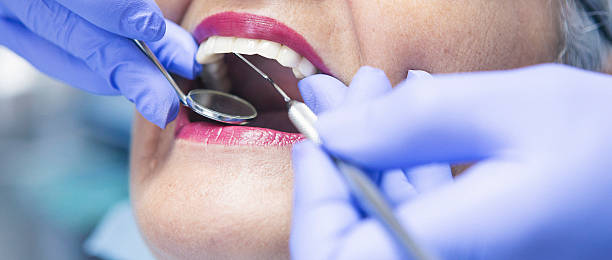 Best Broken or Cracked Tooth Emergency Dentist in Aetna Estates, CO